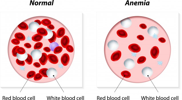 Anemia Treatment Doctors In Chennai